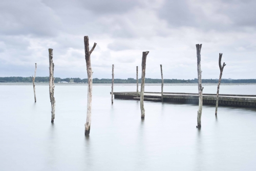 Odontología en Hemofilia. Dra. Irune jauregui